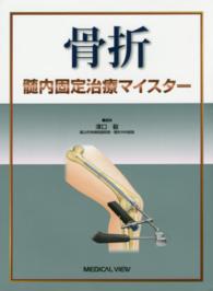 骨折髄内固定治療マイスター