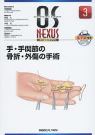 手・手関節の骨折・外傷の手術 ＯＳ　ＮＥＸＵＳ