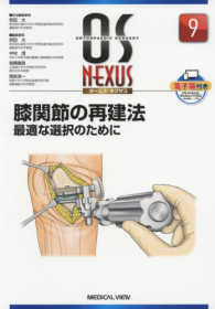 ＯＳ　ＮＥＸＵＳ<br> 膝関節の再建法 - 最適な選択のために