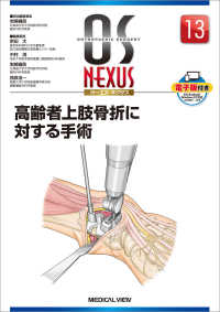 高齢者上肢骨折に対する手術 ＯＳ　ＮＥＸＵＳ