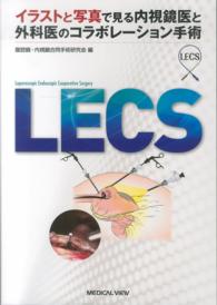 ＬＥＣＳ - イラストと写真で見る内視鏡医と外科医のコラボレーシ