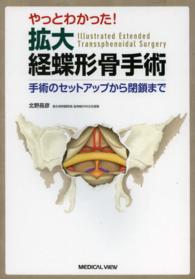 やっとわかった！拡大経蝶形骨手術 - 手術のセットアップから閉鎖まで