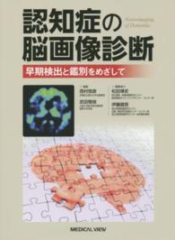 認知症の脳画像診断 - 早期検出と鑑別をめざして