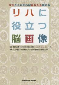 リハに役立つ脳画像 - コツさえわかればあなたも読める