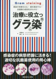 治療に役立つグラム染色―感染の有無をみる！菌を推定する！抗菌薬の感受性がわかる！