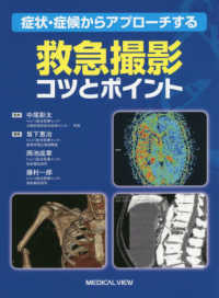 症状・症候からアプローチする救急撮影コツとポイント