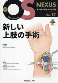 新しい上肢の手術 新ＯＳ　ＮＥＸＵＳ