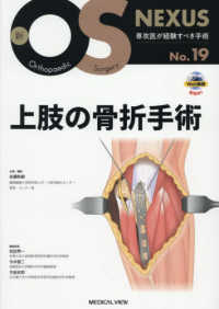 上肢の骨折手術 新ＯＳ　ＮＥＸＵＳ