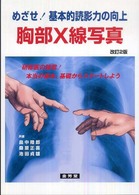 胸部Ｘ線写真 - めざせ！基本的読影力の向上 （改訂２版）