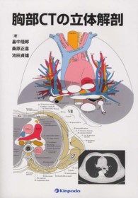 胸部ＣＴの立体解剖