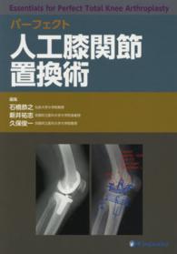 パーフェクト人工膝関節置換術