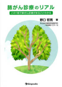 肺がん診療のリアル