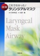 図解ラリンジアルマスク - これでわかった！