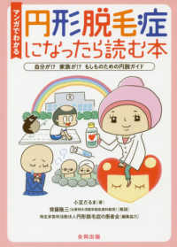 マンガでわかる円形脱毛症になったら読む本―自分が！？家族が！？もしものための円脱ガイド