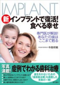 新インプラントで復活！食べる幸せ - 専門医が解説！あなたの歯はここまで甦る