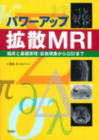 パワーアップ拡散ＭＲＩ - 臨床と基礎原理：拡散現象からＱＳＩまで