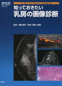 画像診断別冊　ＫＥＹ　ＢＯＯＫシリーズ<br> 知っておきたい乳房の画像診断