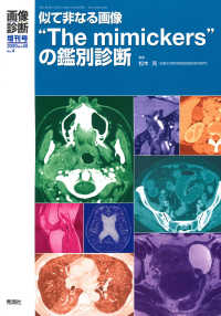 似て非なる画像“Ｔｈｅ　ｍｉｍｉｃｋｅｒｓ”の鑑別診断 画像診断増刊号