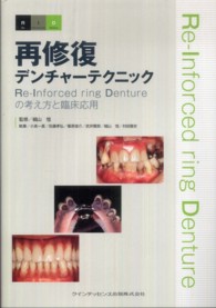 再修復デンチャーテクニック - Ｒｅ－Ｉｎｆｏｒｃｅｄ　ｒｉｎｇ　Ｄｅｎｔｕｒｅの