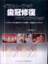 イラストレイテッド歯冠修復アドバンステクニック - ハンズオンで学ぶ製作ステップの勘所：天然歯＆インプ