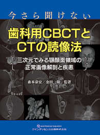 今さら聞けない歯科用ＣＢＣＴとＣＴの読像法 - ―三次元でみる顎顔面領域の正常画像解剖と疾患―