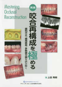 実践咬合再構成を極める - 歯列不正・歯周疾患、多数歯欠損を読み解く