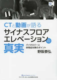 ＣＴと動画が語るサイナスフロアエレベーションの真実 - バイオロジーと併発症対策のポイント