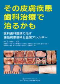 その皮膚疾患歯科治療で治るかも - 医科歯科連携で治す歯性病巣感染＆金属アレルギー