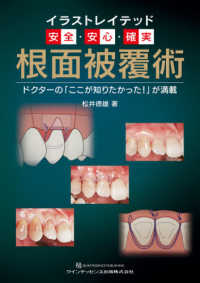 イラストレイテッド安全・安心・確実根面被覆術 - ドクターの「ここが知りたかった！」が満載