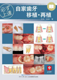 必ず上達自家歯牙移植・再植