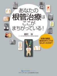 あなたの根管治療はここがまちがっている！ - 失敗の原因，成功のポイントはなんだったのか？