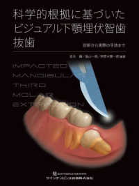 科学的根拠に基づいたビジュアル下顎埋伏智歯抜歯 - 診断から実際の手技まで