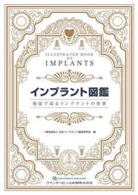 インプラント図鑑 - 視覚で巡るインプラントの世界