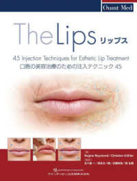 リップス - 口唇の美容治療のための注入テクニック４５ Ｑｕｉｎｔ－Ｍｅｄ