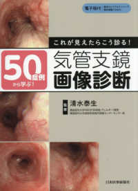 ５０症例から学ぶ！これが見えたらこう診る！気管支鏡画像診断