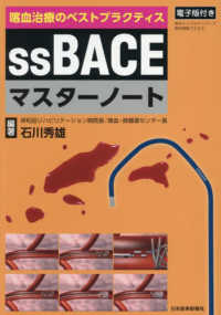 ｓｓＢＡＣＥマスターノート―喀血治療のベストプラクティス
