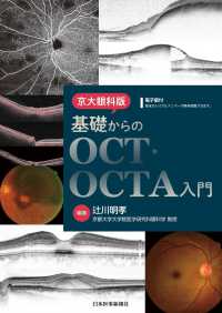 京大眼科版　基礎からのＯＣＴ・ＯＣＴＡ入門
