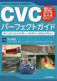 ＣＶＣパーフェクトガイド - 挿入時の安全対策から管理中の感染対策まで／動画を含