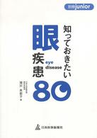 知っておきたい眼疾患８０ 別冊ｊｕｎｉｏｒ