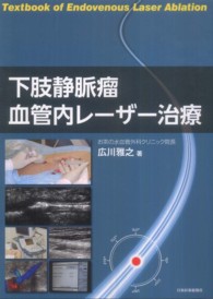 下肢静脈瘤血管内レーザー治療