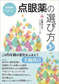 点眼薬の選び方