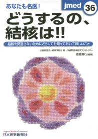 あなたも名医！どうするの、結核は！！ - 結核を見逃さないためにどうしても知っておいてほしい ｊｍｅｄ