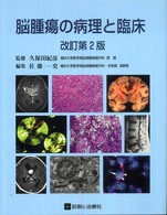 脳腫瘍の病理と臨床 （改訂第２版）