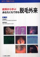 症例から学ぶあなたにもできる脱毛外来