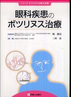 眼科疾患のボツリヌス治療 シリーズボツリヌス治療の実際