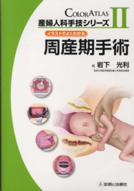 周産期手術 - イラストでよくわかる 産婦人科手技シリーズ