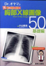 Ｄｒ．オヤマの見る読むわかる胸部Ｘ線画像５０ 〈基礎編〉