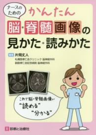 ナースのためのかんたん脳・脊髄画像の見かた・読みかた - これで脳・脊髄画像が“読める”“分かる”