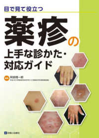 目で見て役立つ　薬疹の上手な診かた・対応ガイド