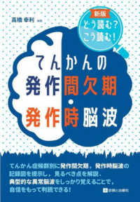 てんかんの発作間欠期・発作時脳波 - どう読む？こう読む！ （新版）